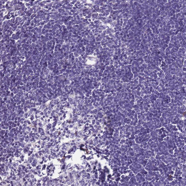 KCTD19 Antibody in Immunohistochemistry (Paraffin) (IHC (P))