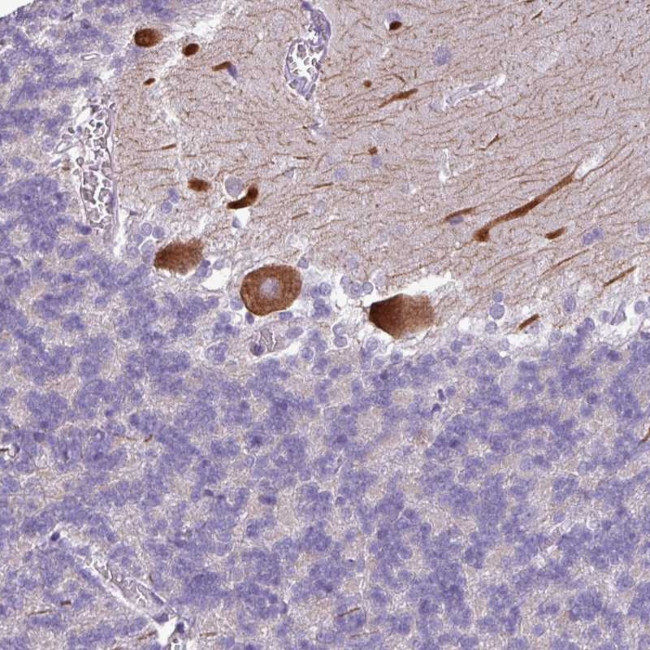 PSRC1 Antibody in Immunohistochemistry (Paraffin) (IHC (P))