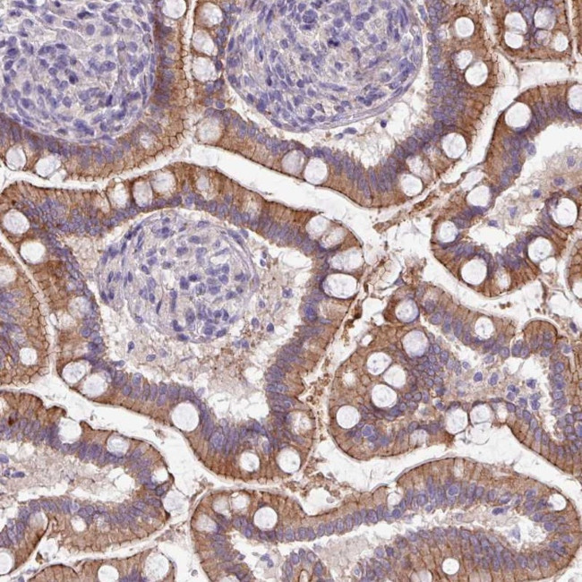 ACAP3 Antibody in Immunohistochemistry (Paraffin) (IHC (P))