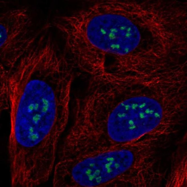 MYRFL Antibody in Immunocytochemistry (ICC/IF)