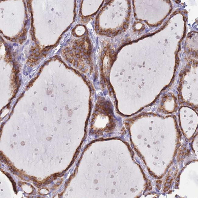 OR52I2 Antibody in Immunohistochemistry (Paraffin) (IHC (P))