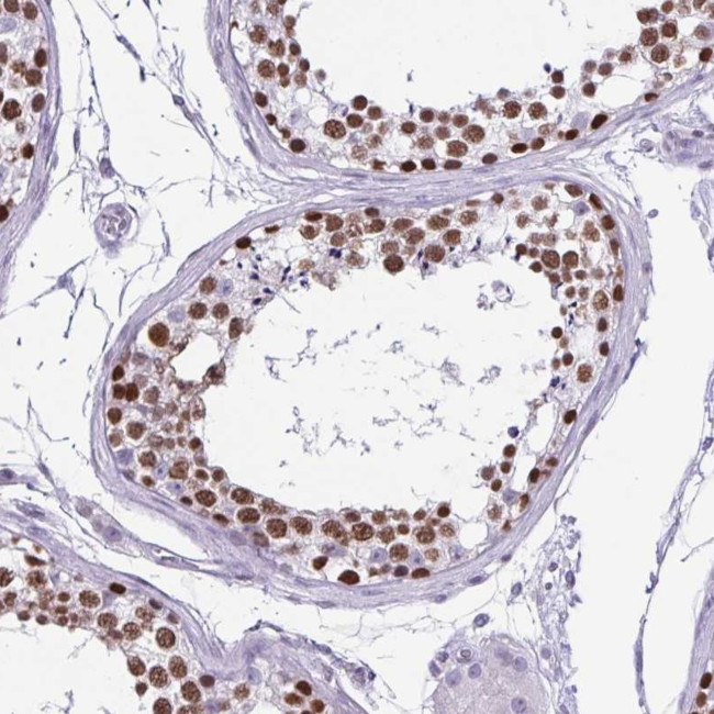 VCX Antibody in Immunohistochemistry (Paraffin) (IHC (P))