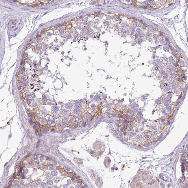WDR90 Antibody in Immunohistochemistry (IHC)