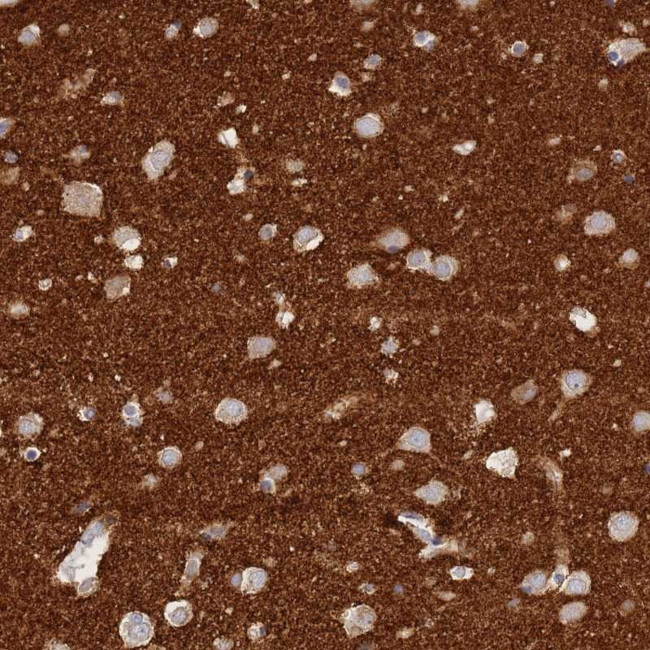 TIFAB Antibody in Immunohistochemistry (Paraffin) (IHC (P))