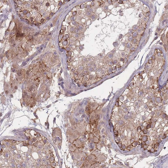 TMEM232 Antibody in Immunohistochemistry (Paraffin) (IHC (P))