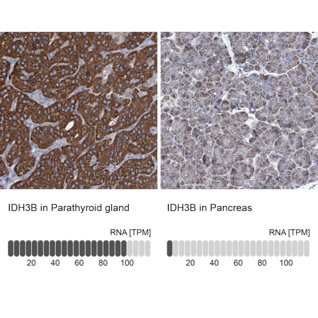 IDH3B Antibody in Immunohistochemistry (IHC)