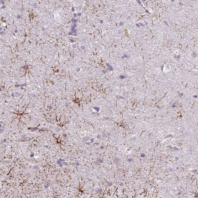 SLC35E3 Antibody in Immunohistochemistry (IHC)