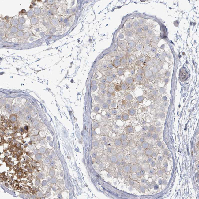 LILRA4 Antibody in Immunohistochemistry (Paraffin) (IHC (P))