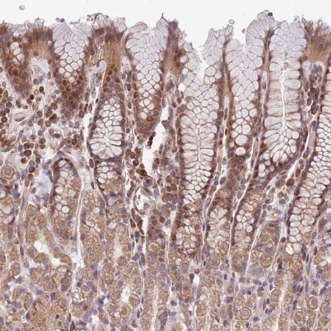 CHD9 Antibody in Immunohistochemistry (IHC)
