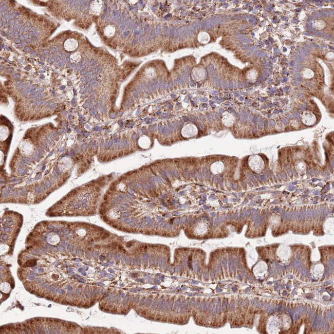 DOCK6 Antibody in Immunohistochemistry (Paraffin) (IHC (P))