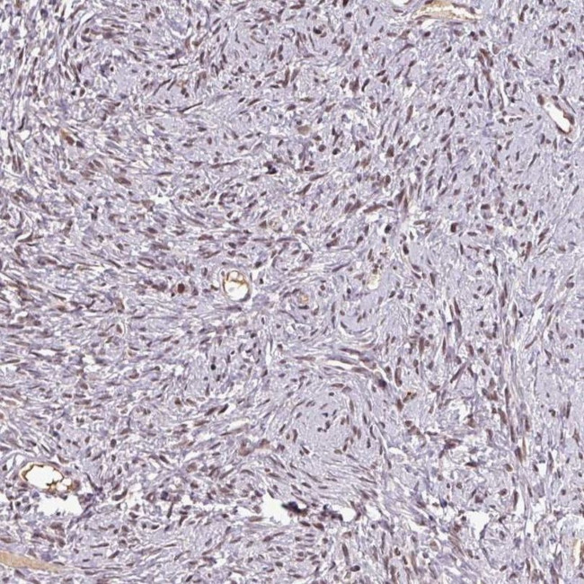 NOB1 Antibody in Immunohistochemistry (IHC)