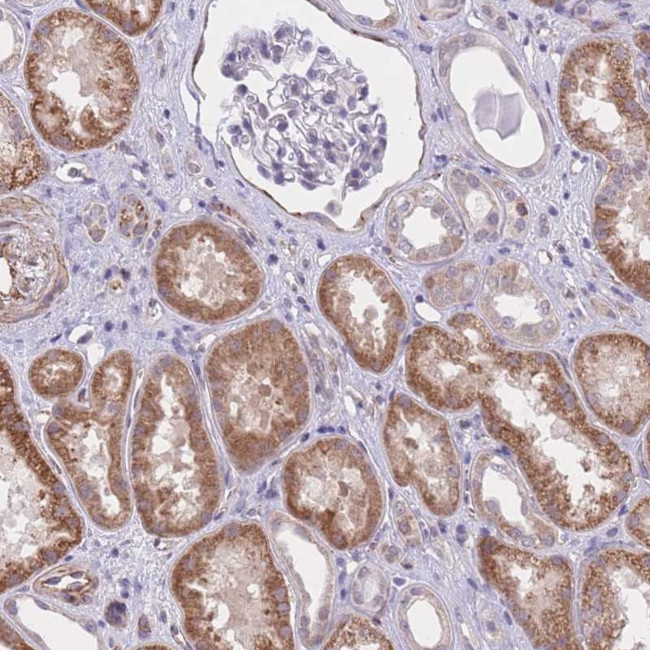 QTRT1 Antibody in Immunohistochemistry (Paraffin) (IHC (P))