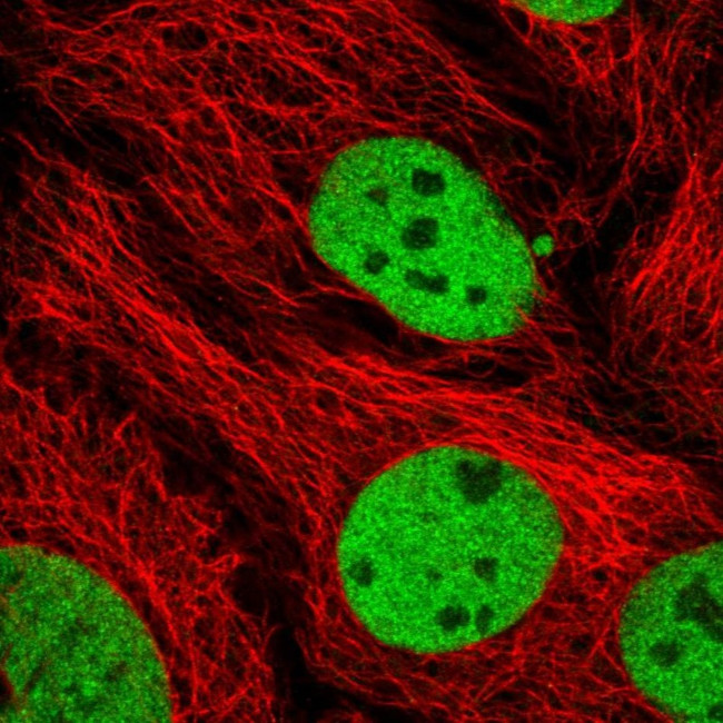 UBXN7 Antibody in Immunocytochemistry (ICC/IF)