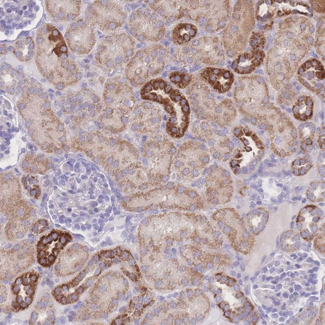 NBEAL1 Antibody in Immunohistochemistry (Paraffin) (IHC (P))