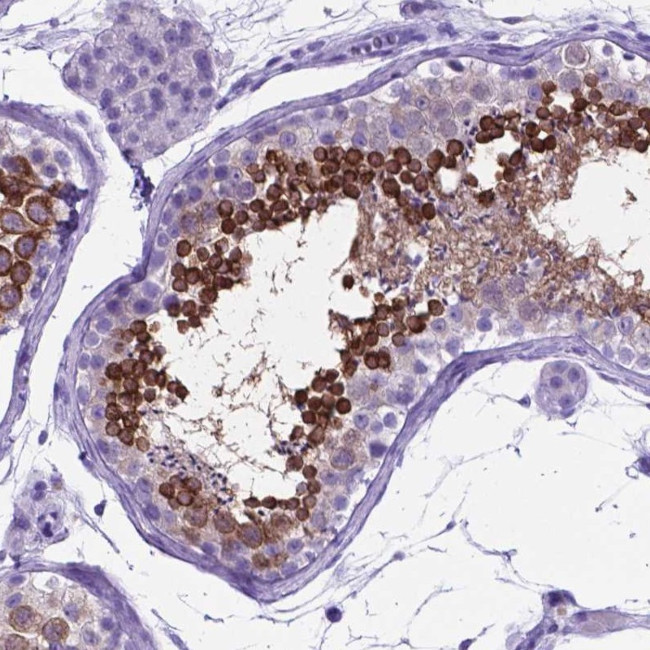 C16orf71 Antibody in Immunohistochemistry (Paraffin) (IHC (P))