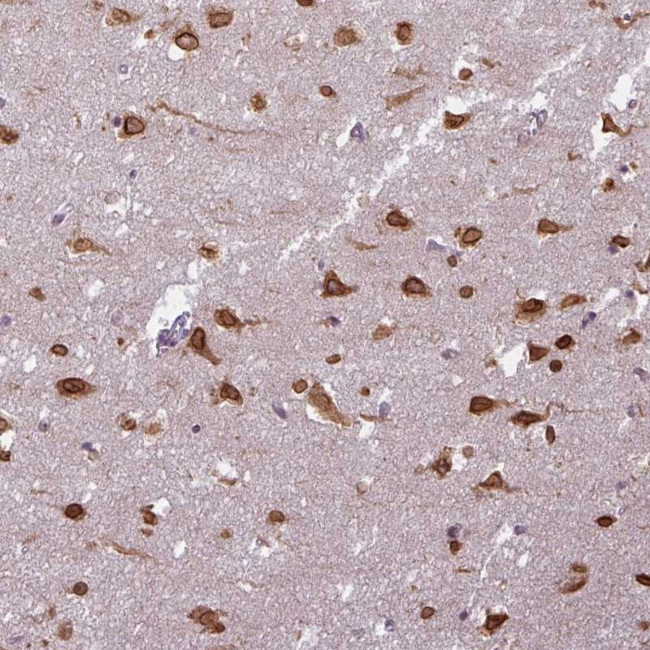 COX18 Antibody in Immunohistochemistry (Paraffin) (IHC (P))