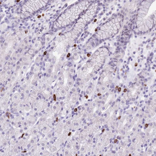 BHMG1 Antibody in Immunohistochemistry (Paraffin) (IHC (P))