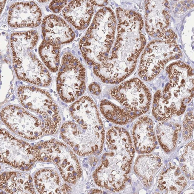 INTS2 Antibody in Immunohistochemistry (Paraffin) (IHC (P))