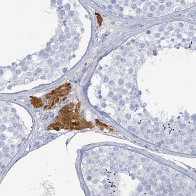 HEATR5A Antibody in Immunohistochemistry (Paraffin) (IHC (P))