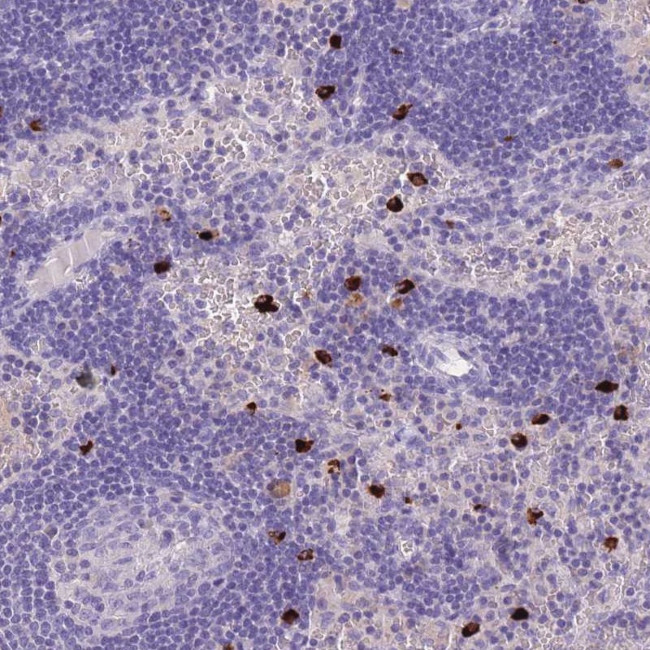 TPSD1 Antibody in Immunohistochemistry (Paraffin) (IHC (P))