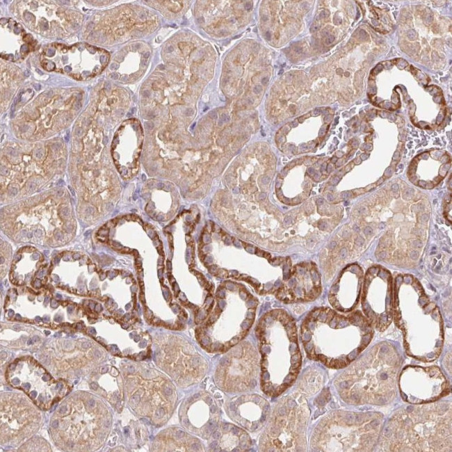 PALM Antibody in Immunohistochemistry (Paraffin) (IHC (P))