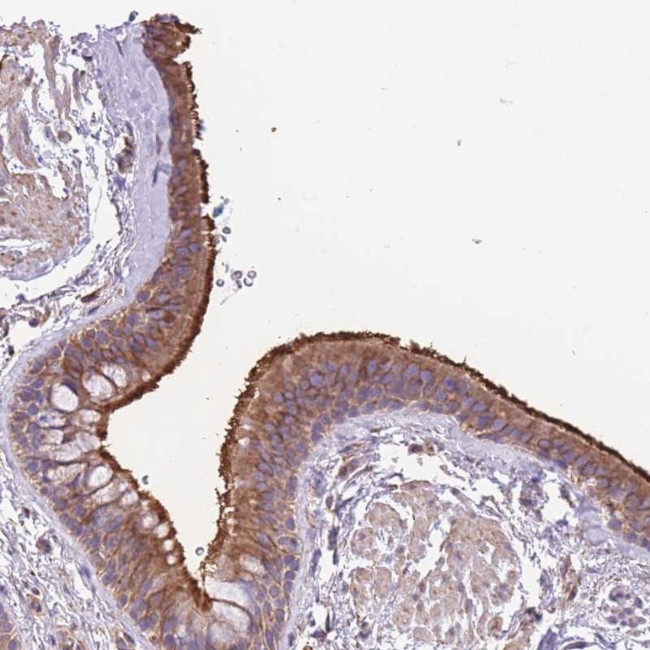 WRCH1 Antibody in Immunohistochemistry (Paraffin) (IHC (P))