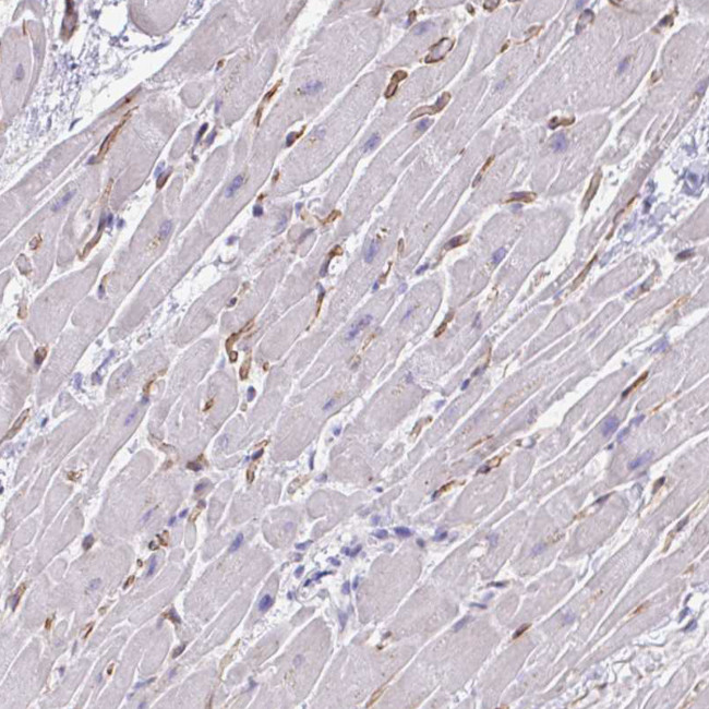KRIT1 Antibody in Immunohistochemistry (Paraffin) (IHC (P))