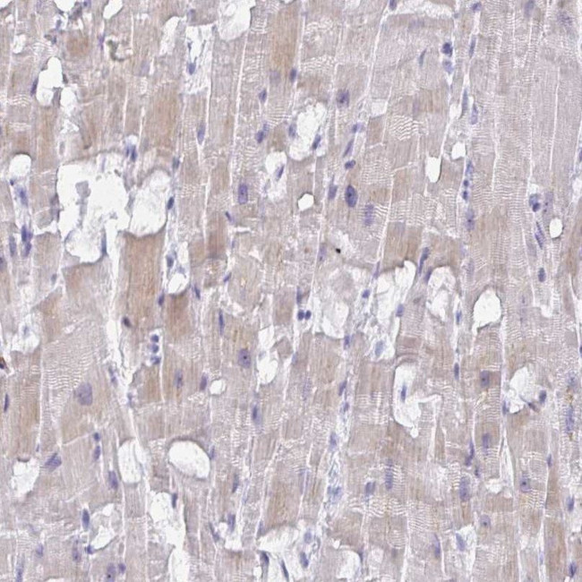 FTSJ2 Antibody in Immunohistochemistry (IHC)