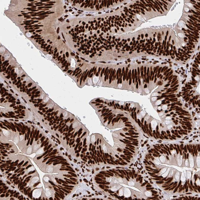 CNKSR3 Antibody in Immunohistochemistry (Paraffin) (IHC (P))