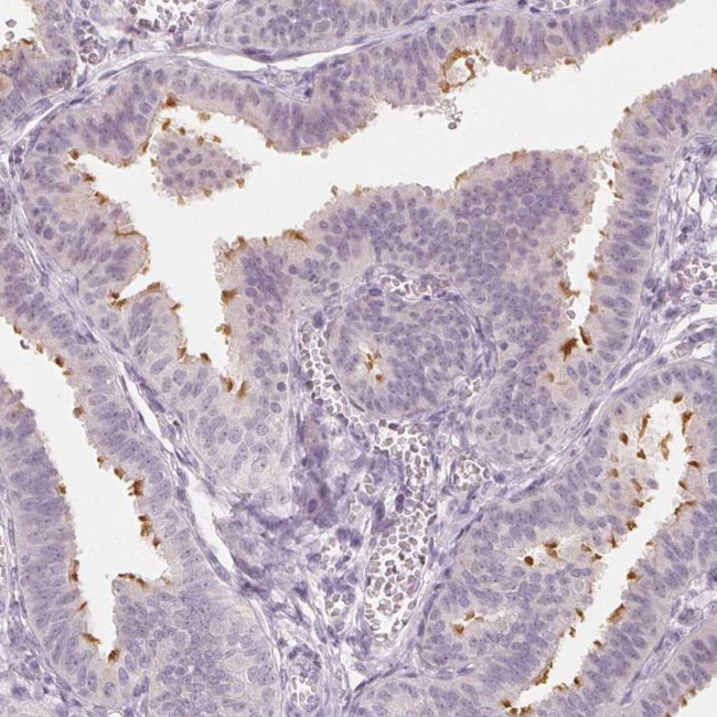 C1orf194 Antibody in Immunohistochemistry (Paraffin) (IHC (P))