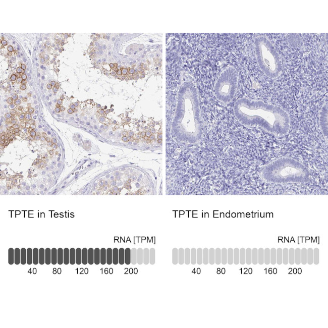 PTEN2 Antibody in Immunohistochemistry (IHC)