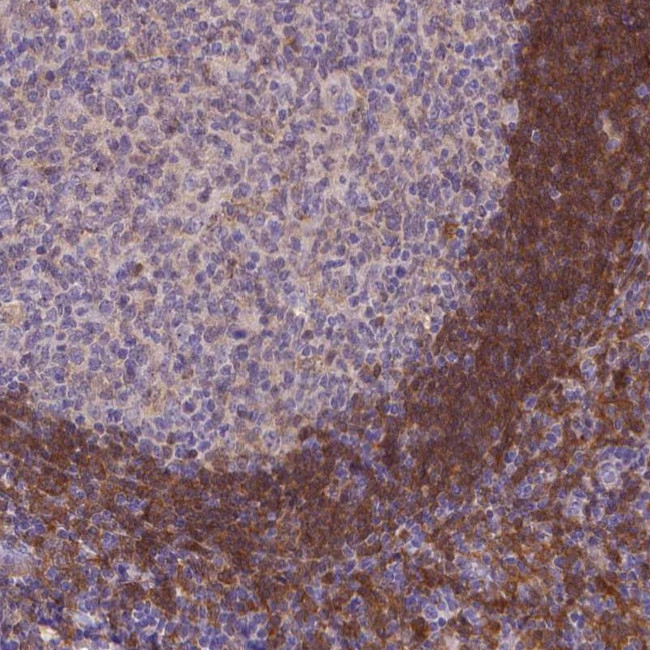 FGD2 Antibody in Immunohistochemistry (Paraffin) (IHC (P))