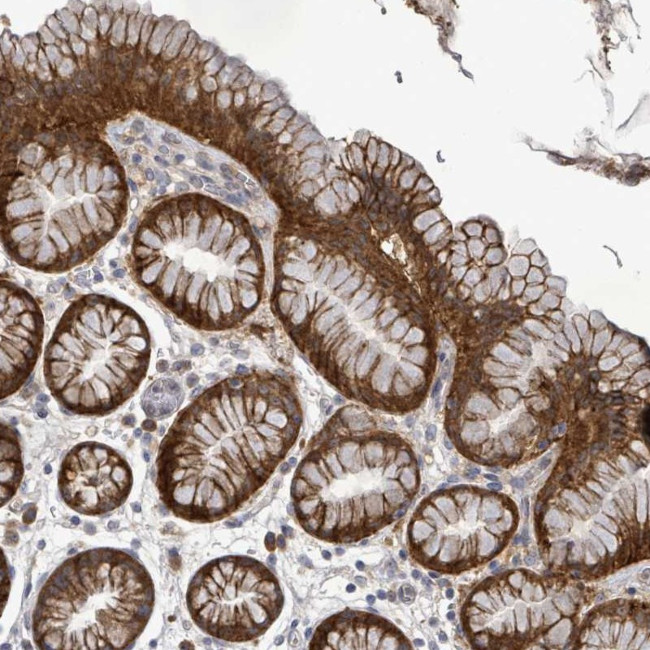 ATP13A1 Antibody in Immunohistochemistry (Paraffin) (IHC (P))
