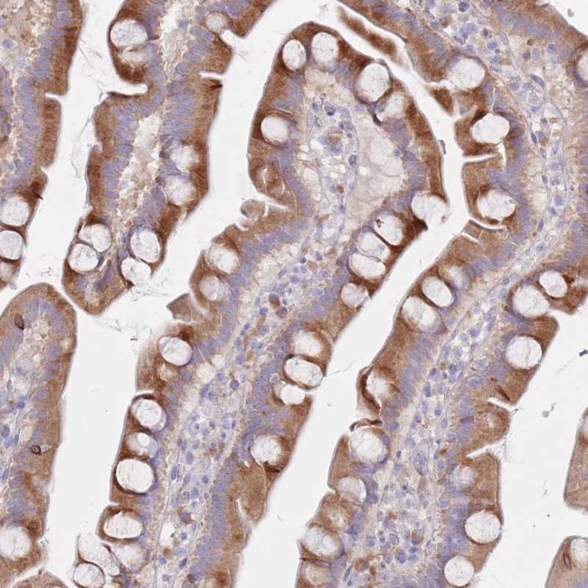 SPATS1 Antibody in Immunohistochemistry (Paraffin) (IHC (P))