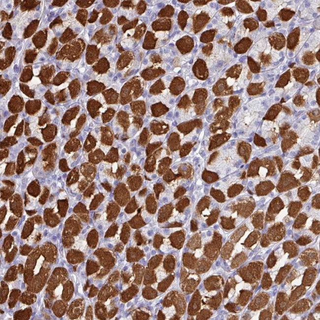 PEX10 Antibody in Immunohistochemistry (Paraffin) (IHC (P))