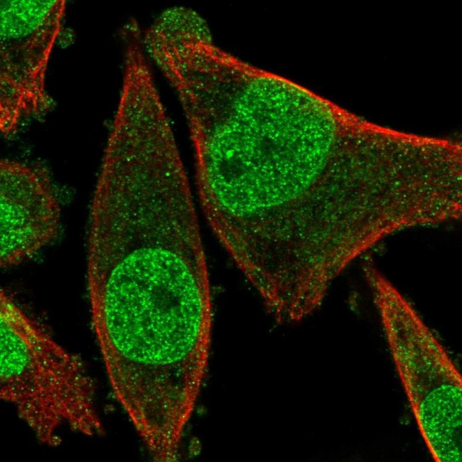FRAT2 Antibody in Immunocytochemistry (ICC/IF)