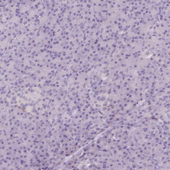 HTR3E Antibody in Immunohistochemistry (Paraffin) (IHC (P))