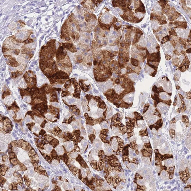 ZNF627 Antibody in Immunohistochemistry (Paraffin) (IHC (P))