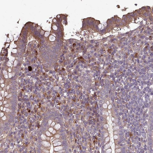 NHSL2 Antibody in Immunohistochemistry (IHC)