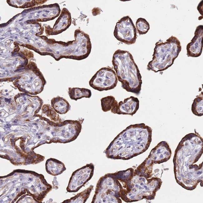 FAM227B Antibody in Immunohistochemistry (Paraffin) (IHC (P))