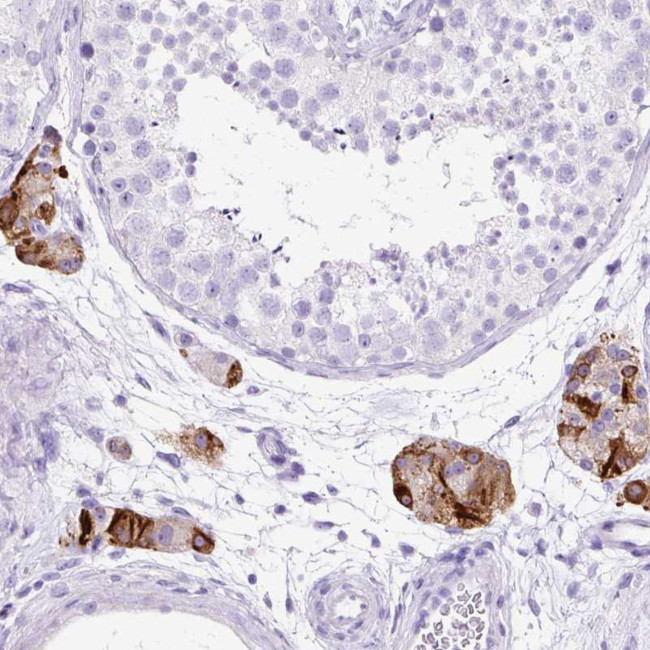 STOX2 Antibody in Immunohistochemistry (Paraffin) (IHC (P))