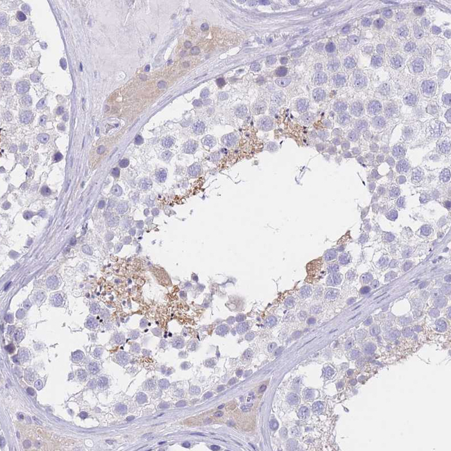 SSUH2 Antibody in Immunohistochemistry (Paraffin) (IHC (P))