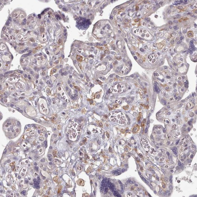 COL8A2 Antibody in Immunohistochemistry (IHC)