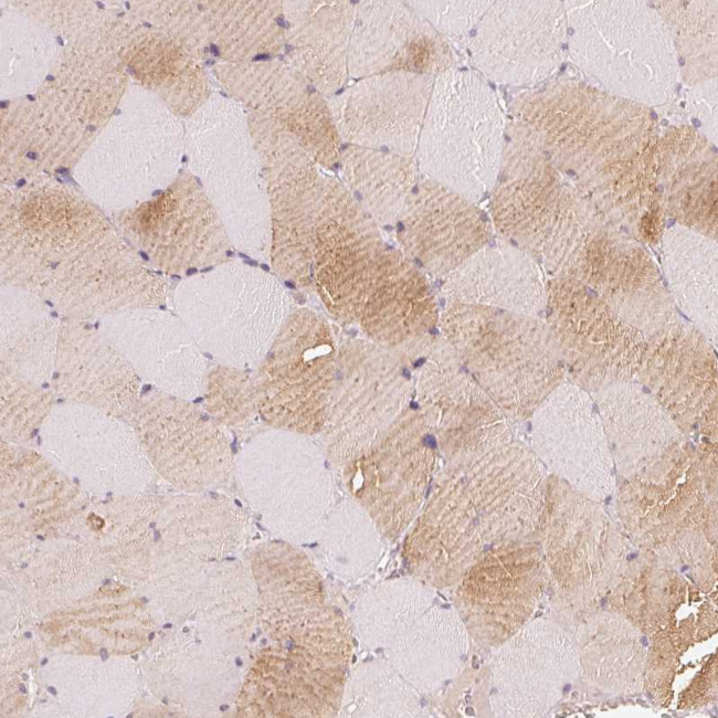 CFHR2 Antibody in Immunohistochemistry (Paraffin) (IHC (P))