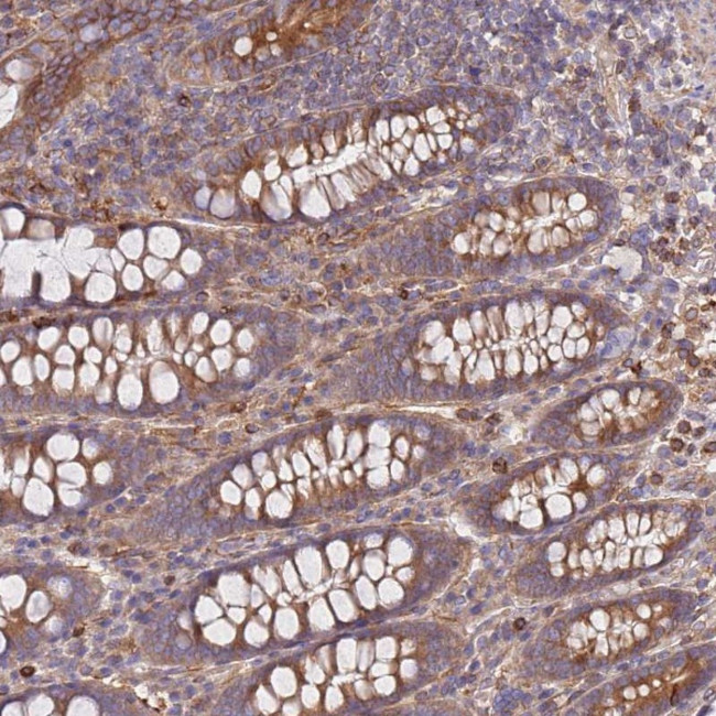 REM1 Antibody in Immunohistochemistry (Paraffin) (IHC (P))