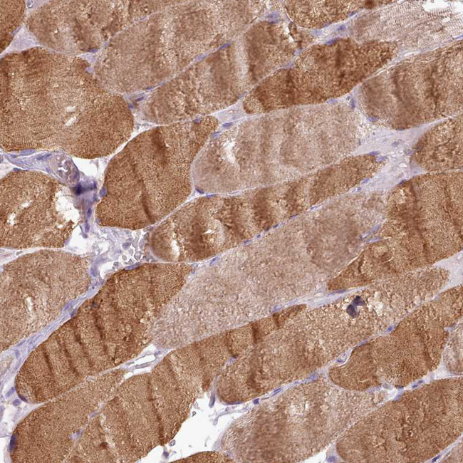 NTN4 Antibody in Immunohistochemistry (Paraffin) (IHC (P))