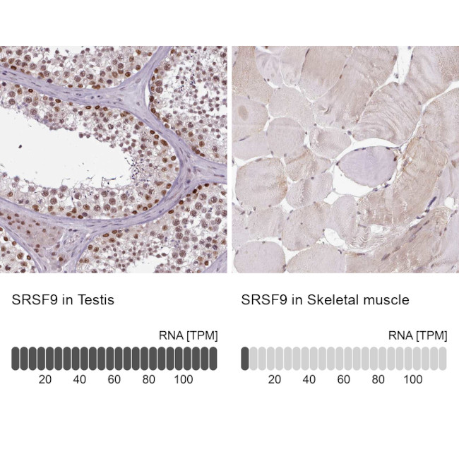 SRSF9 Antibody