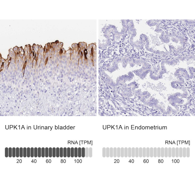 UPK1A Antibody