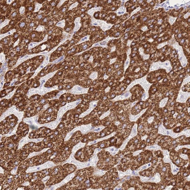 ACSM4 Antibody in Immunohistochemistry (Paraffin) (IHC (P))