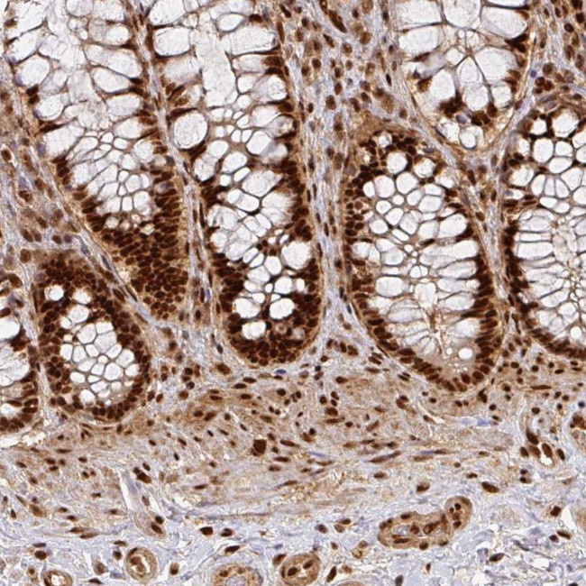 DATF1 Antibody in Immunohistochemistry (Paraffin) (IHC (P))